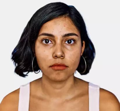 Dark Circles